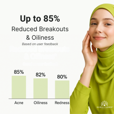 Green Tea Anti-Acne Serum, Global Fashion, 50 ml