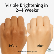 Сироватка для обличчя, що освітлює, Global Fashion, Dark Knuckles Remover Serum, 50ml