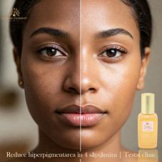 Ser cu vitamina C, Global Fashion, Vitamin C Serum, 50 ml