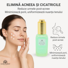 Ser Peeling cu acizi AHA+BHA, Global Fashion,  Aha+Bha Serum Peeling Solution Face Serum, 50 ml Ser Peeling cu acizi AHA+BHA, Global Fashion,  Aha+Bha Serum Peeling Solution Face Serum, 50 ml
